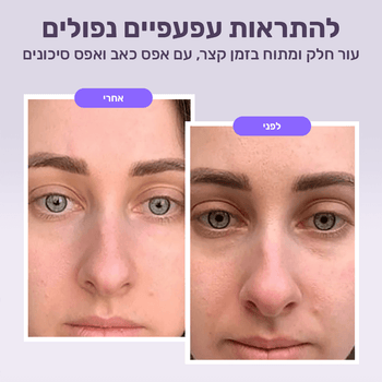 מדבקות זרע סלמון לשיפור קמטים ונפיחות סביב העיניים
