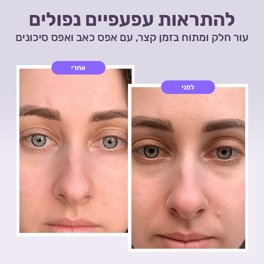 מדבקות זרע סלמון לשיפור קמטים ונפיחות סביב העיניים